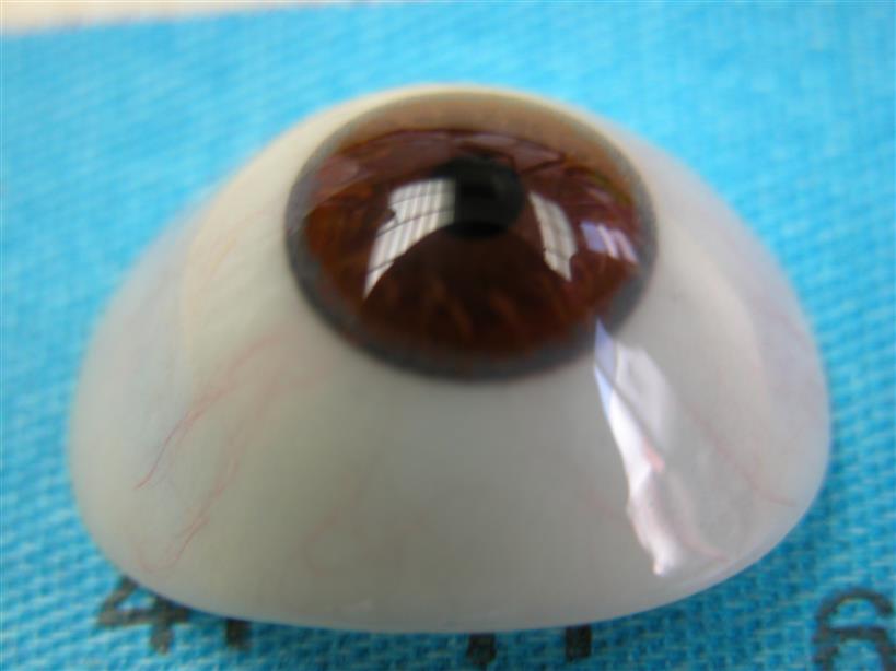 prothese oculaire fine extrado